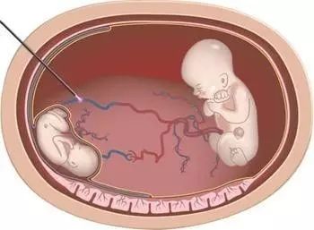 大本视频 博主发布的大本视频视频内容