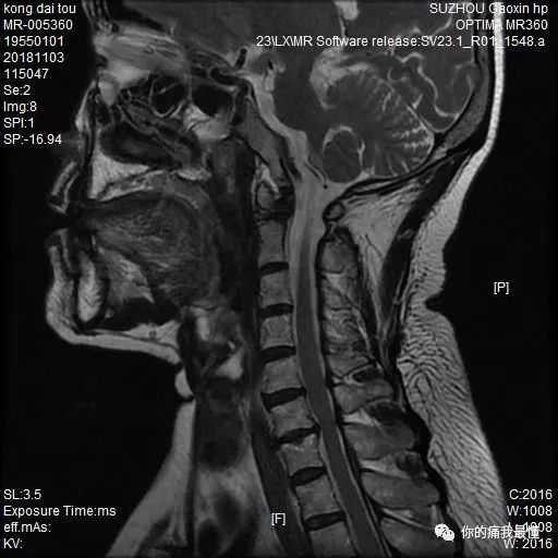 火影忍者主播咩咩 咩咩可以加上关键词搜索