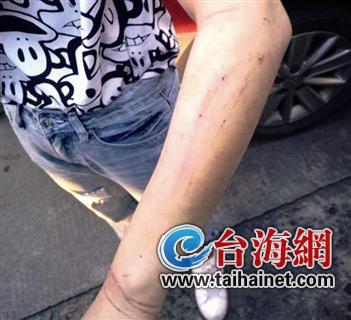 吃瓜暗黑网 其真实性需用户自行甄别