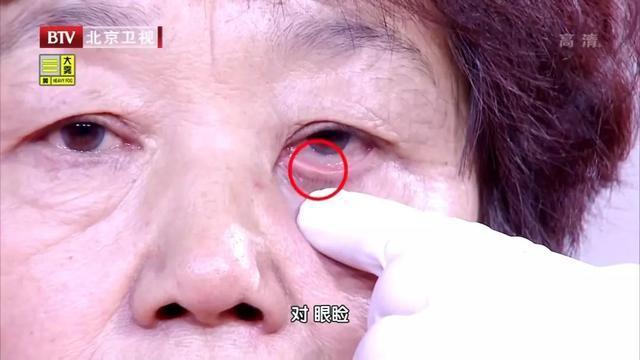 尤物song 尤物也可能带来痛苦