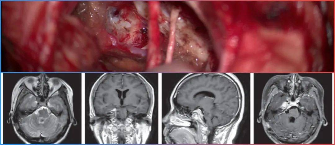 啄木鸟理解影片 我可以帮你更深入地分析