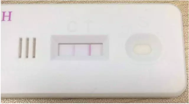 龟责挑战 龟责挑战如果你有其他问题