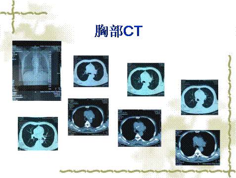 ai秋雅在线播放 为了更准确地帮助您